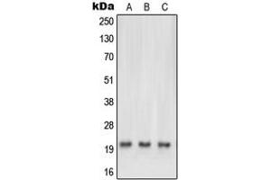 Western blot analysis of NRAS/HRAS/KRAS expression in HEK293T (A), HeLa (B), mouse brain (C), rat heart (D) whole cell lysates. (NRAS/HRAS/KRAS Antikörper  (N-Term))