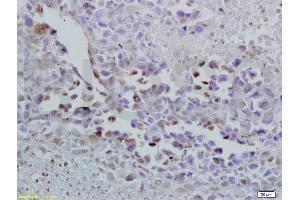 Formalin-fixed and paraffin embedded mouse lymphoma labeled with Anti-Oct-3/Oct-4 Polyclonal Antibody, Unconjugated (ABIN737826) at 1:200 followed by conjugation to the secondary antibody and DAB staining.