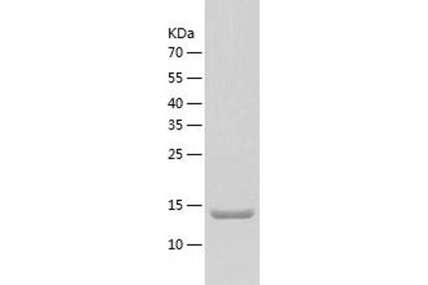 MRPL2 Protein (AA 84-202) (His tag)