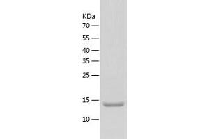 MRPL2 Protein (AA 84-202) (His tag)