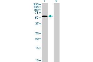 Western Blot analysis of KLHL7 expression in transfected 293T cell line by KLHL7 MaxPab polyclonal antibody. (KLHL7 Antikörper  (AA 1-586))