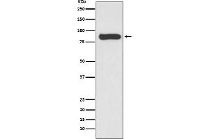 Western blot analysis of STAT4 expression in Hela cell lysate.