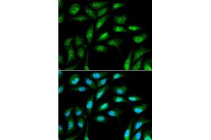 Immunofluorescence analysis of MCF-7 cells using B2M antibody. (beta-2 Microglobulin Antikörper  (AA 21-119))