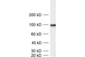 dilution: 1 : 1000, sample: crude synaptic vesicle fraction of rat brain (LP2) (SV2B Antikörper  (AA 2-17))