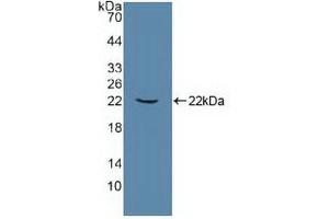 Detection of Recombinant ATP1a1, Human using Polyclonal Antibody to ATPase, Na+/K+ Transporting Alpha 1 Polypeptide (ATP1a1) (ATP1A1 Antikörper  (AA 493-660))