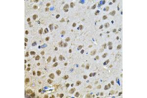 Immunohistochemistry of paraffin-embedded rat brain using PPID Antibody (ABIN5974177) at dilution of 1/100 (40x lens). (PPID Antikörper)