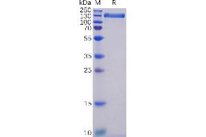 Human Protein, hFc Tag on SDS-PAGE under reducing condition.