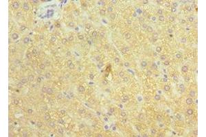 Immunohistochemistry of paraffin-embedded human liver tissue using ABIN7148555 at dilution of 1:100 (ATP7B Antikörper  (AA 1166-1465))