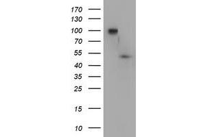 Western Blotting (WB) image for anti-Docking Protein 7 (DOK7) antibody (ABIN1497885) (DOK7 Antikörper)