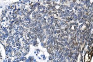 IHC analysis of METTL3 using anti-METTL3 antibody (ABIN7602808).