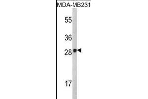 Western blot analysis of IL2 Antibody (Center) (ABIN390899 and ABIN2841106) in MDA-M cell line lysates (35 μg/lane). (IL-2 Antikörper  (AA 50-77))
