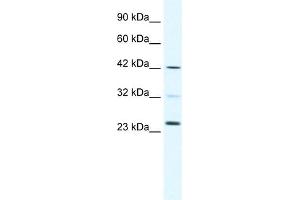 WB Suggested Anti-E2F1 Antibody Titration:  0. (E2F1 Antikörper  (C-Term))