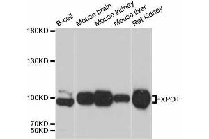 Western blot analysis of extracts of various cell lines, using XPOT antibody.