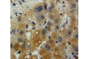 Used in DAB staining on fromalin fixed paraffin-embedded Liver tissue (IL-10 Antikörper  (AA 1-178))