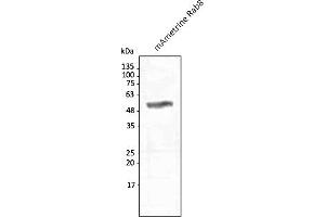 Western Blotting (WB) image for anti-mAmetrine Fluorescent Protein antibody (ABIN7273095) (mAmetrine Fluorescent Protein Antikörper)