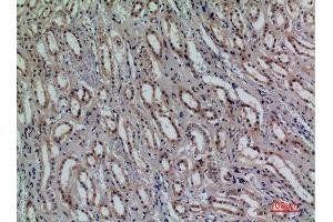 Immunohistochemistry (IHC) analysis of paraffin-embedded Human Kidney, antibody was diluted at 1:100. (CD159a/c (Internal Region) Antikörper)