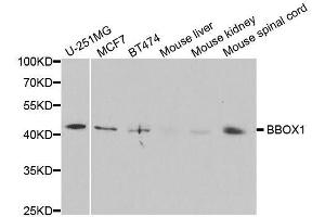 Western blot analysis of extracts of various cell lines, using BBOX1 antibody. (BBOX1 Antikörper  (AA 1-180))