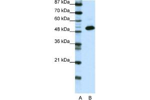 WB Suggested Anti-TADA3L Antibody Titration:  0. (TADA3L Antikörper  (N-Term))
