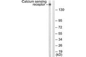 Western blot analysis of extracts from LOVO cells, using Calcium Sensing Receptor (Ab-888) Antibody. (CASR Antikörper  (AA 854-903))