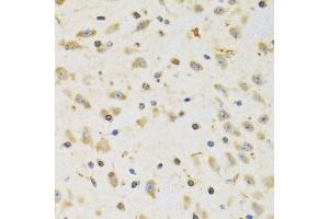 Immunohistochemistry of paraffin-embedded rat brain using RPS12 antibody (ABIN5973491) at dilution of 1/100 (40x lens). (RPS12 Antikörper)