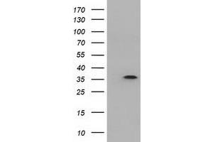 Western Blotting (WB) image for anti-Deoxynucleotidyltransferase, Terminal, Interacting Protein 1 (DNTTIP1) antibody (ABIN1497876) (DNTTIP1 Antikörper)