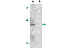 Western blot analysis of IL23A in Raji lysate with IL23A polyclonal antibody  at 1 ug/mL in the (A) absence and (B) presence of blocking peptide. (IL23A Antikörper  (C-Term))