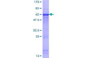 Haptoglobin Protein (HP) (AA 1-281) (GST tag)