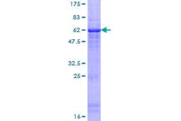 Haptoglobin Protein (HP) (AA 1-281) (GST tag)