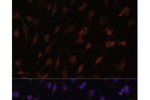 Immunofluorescence analysis of C6 cells using POR Polyclonal Antibody at dilution of 1:100 (40x lens). (POR Antikörper)