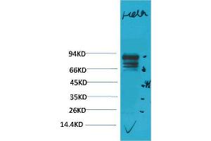 Western Blotting (WB) image for anti-Signal Transducer and Activator of Transcription 3 (Acute-Phase Response Factor) (STAT3) antibody (ABIN3188048) (STAT3 Antikörper)