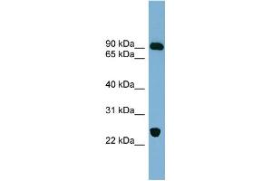 WB Suggested Anti-VPS53 Antibody Titration: 0. (VPS53 Antikörper  (Middle Region))