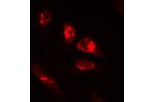 Immunofluorescent analysis of OCT2 staining in HeLa cells. (Oct-2 Antikörper  (N-Term))