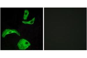 Immunofluorescence analysis of HeLa cells, using GPR18 Antibody. (GPR18 Antikörper  (AA 131-180))