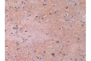 IHC-P analysis of Rat Spinal Cord Tissue, with DAB staining. (CAPNL1 Antikörper  (AA 387-694))