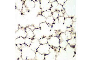 Immunohistochemistry of paraffin-embedded mouse lung using MAPK9 antibody at dilution of 1:200 (400x lens). (JNK2 Antikörper)
