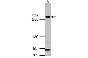 WB Image Sample (30 ug of whole cell lysate) A: H1299 5% SDS PAGE antibody diluted at 1:1000 (Laminin beta 1 Antikörper  (C-Term))