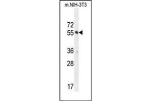 Western Blotting (WB) image for anti-CTD (Carboxy-Terminal Domain, RNA Polymerase II, Polypeptide A) Small Phosphatase Like 2 (CTDSPL2) (AA 55-84), (N-Term) antibody (ABIN951727)