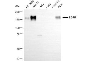 Western blotting analysis using EGFR antibody (ABIN7798460).