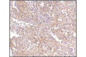 Immunohistochemistry of RAP80 in human spleen tissue with this product at 2. (UIMC1 Antikörper  (C-Term))