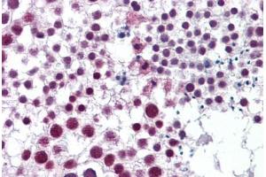 Human Testis: Formalin-Fixed, Paraffin-Embedded (FFPE) (Cyclin H Antikörper  (AA 1-110))