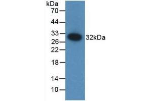 Detection of Recombinant F12, Mouse using Polyclonal Antibody to Coagulation Factor XII (F12) (F12 Antikörper  (AA 352-587))
