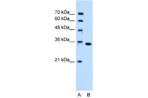 WB Suggested Anti-TYMS Antibody Titration:  0. (TYMS Antikörper  (C-Term))