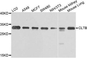 Western blot analysis of extracts of various cells, using CLTB antibody. (CLTB Antikörper)