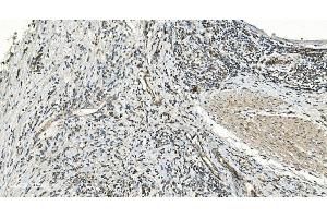 IHC analysis of FLCN using anti-FLCN antibody (ABIN7602491).