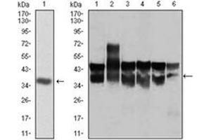 Western Blotting (WB) image for anti-Cyclin-Dependent Kinase 2 (CDK2) antibody (ABIN1106645) (CDK2 Antikörper)