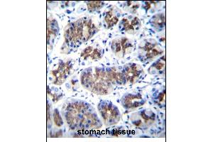 T Antibody (Center) (ABIN656855 and ABIN2846060) immunohistochemistry analysis in formalin fixed and paraffin embedded human stomach tissue followed by peroxidase conjugation of the secondary antibody and DAB staining.