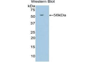 Western Blotting (WB) image for anti-Nuclear Receptor Subfamily 3, Group C, Member 1 (Glucocorticoid Receptor) (NR3C1) (AA 532-730) antibody (ABIN1860047) (Glucocorticoid Receptor Antikörper  (AA 532-730))