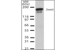 Western Blotting (WB) image for anti-DNA (Cytosine-5)-Methyltransferase 1 (DNMT1) (AA 637-650) antibody (ABIN492452) (DNMT1 Antikörper  (AA 637-650))