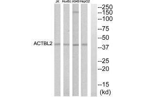 Western blot analysis of extracts from HepG2, HuvEc, Jurkat and A549 cells, using ACTBL2 antibody. (ACTBL2 Antikörper  (Internal Region))