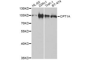 Western blot analysis of extracts of various cell lines, using CPT1A Antibody (ABIN5973053) at 1/1000 dilution.
